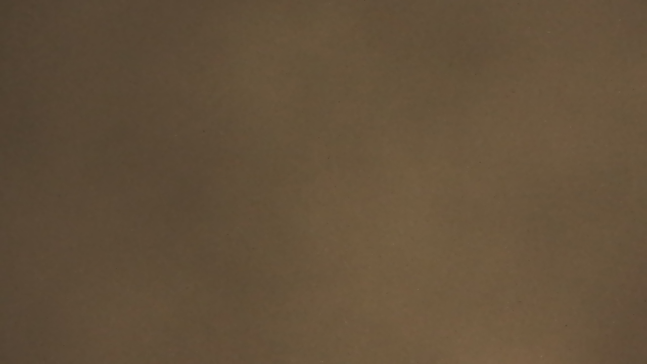 Thumbnail for current weather camera view from Chippenham Hospital in Richmond, Virginia