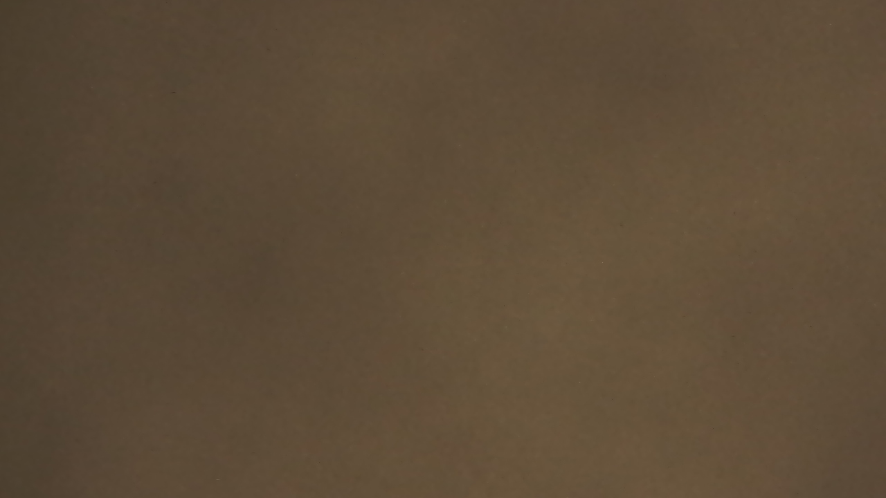 Thumbnail for current weather camera view from Chippenham Hospital in Richmond, Virginia