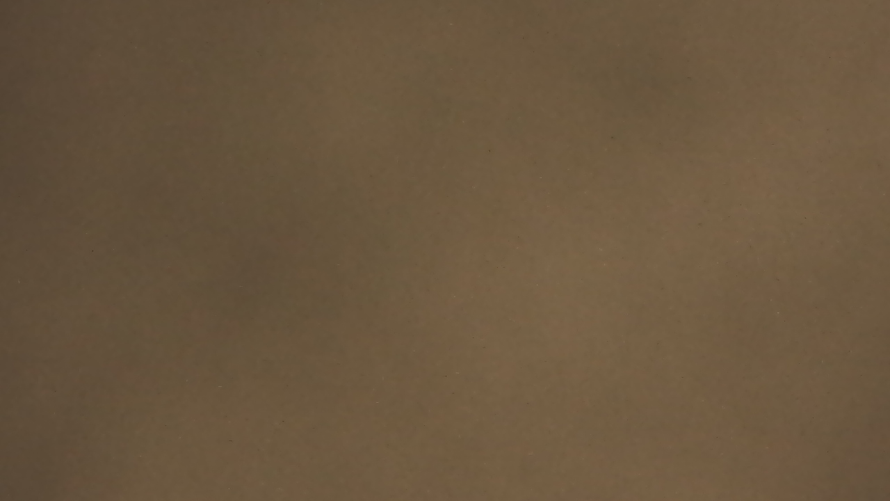 Thumbnail for current weather camera view from Chippenham Hospital in Richmond, Virginia