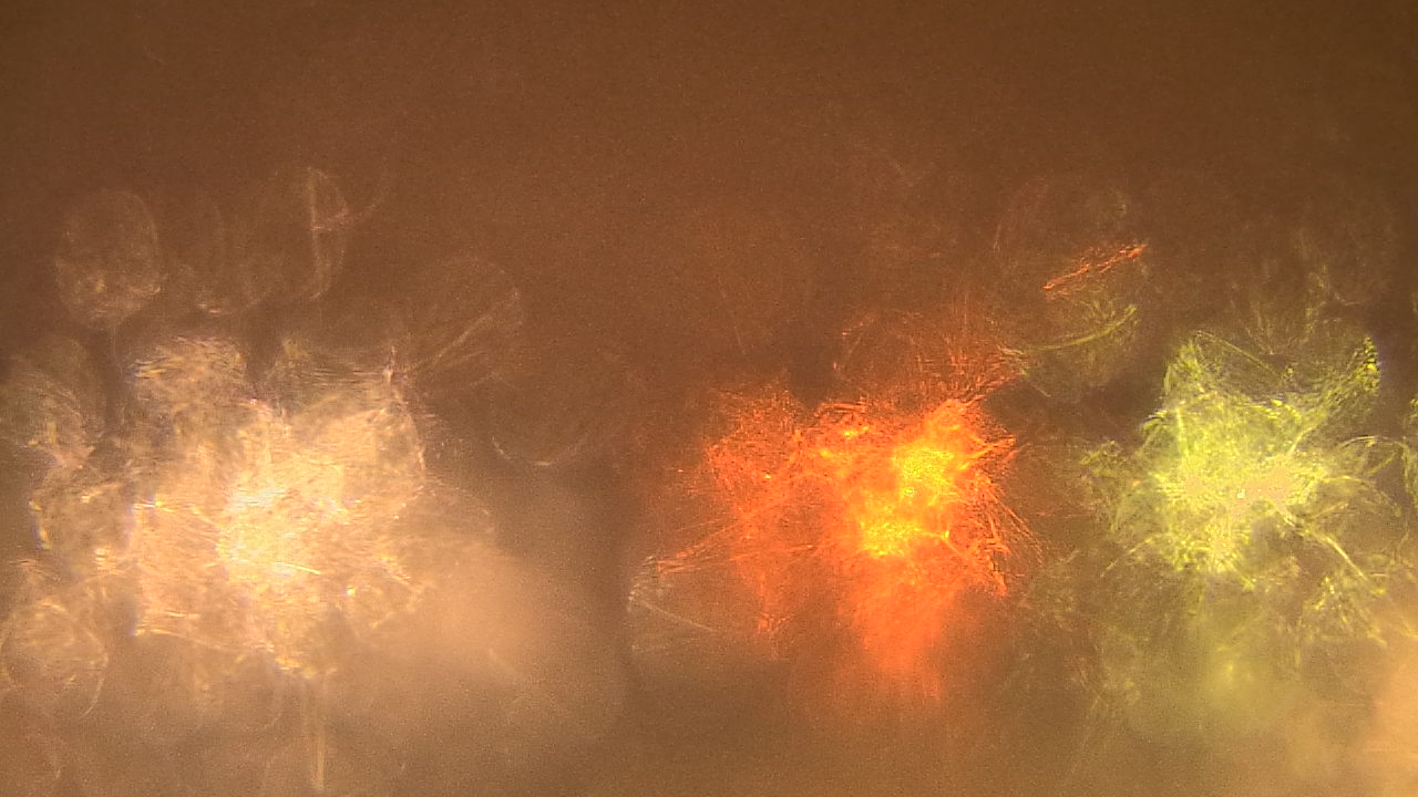 Thumbnail for current weather camera view from Gesu School in University Heights, Ohio