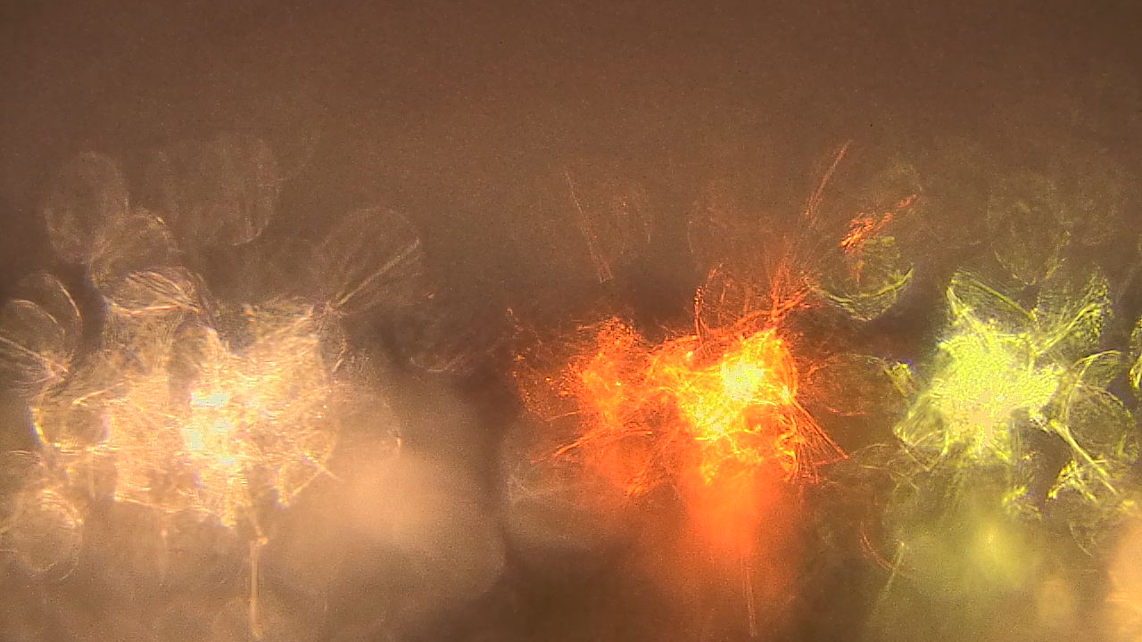 Thumbnail for current weather camera view from Gesu School in University Heights, Ohio